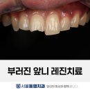 동행치과의원 네이버블로그