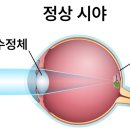 성모안경 이미지