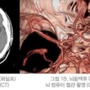 "두통" 이미지