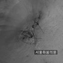 서울화봄의원 네이버블로그