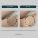in_waxing 이미지