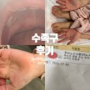 7형제약국 | 힘들었던 수족구 후기 증상 통증 음식 약 전염 격리 기간 등원 빨리 낫는 법 공유