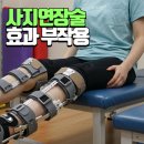 사지 | 사지연장술 부작용 후기 키크는 수술 비용은?
