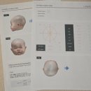 더존픽업 | [두상교정헬멧] 쌍둥이 사두, 단두 / 비바3D헬멧 위례센터 상담, 픽업 후기