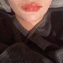 셀리라인 | 자연스러운 얼굴라인 ”셀리데이의원“ 솔직 방문 후기