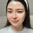 (주)더스킨솔루션 | 홀리코스 스킨바이옴 PDRN앰플 세트｜mts 홈케어로 트러블 피부 셀프관리 후기
