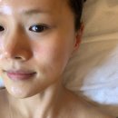 장안로52번길 | 분당 피부관리 | 고원장의 모공세척테라피 분당점 • 룩서스 플라즈마 시술 솔직 후기