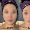 라인댄스 | 부산 기장 올바른뷰티연구소 얼굴근막마사지 받고 온 리얼 후기 💆🏻‍♀️
