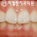 미켈란치과의원 이미지