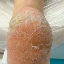 의료원로 | 군산 발각질 고민 끝? 패디푸스네일 군산점 다녀온 솔직 후기