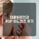 대정안과의원 | 태릉밝은안과 RGP 하드렌즈 후기 (1)