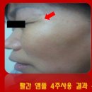 지연피부샵