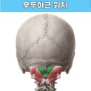 혜스테틱