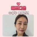 방배중앙로23길 42-3 | 수성구 윤곽관리 비대칭관리 고민 예쁘디온 미세전류 괄사 라인관리 찐 후기