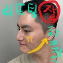 닥터윤뷰티플의원 | 성성동피부과 리프팅 잘하는 곳 찾는 2가지 팁