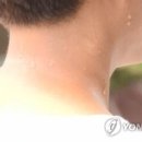 약선제한의원의 한약이야기 - 다한증