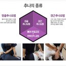 둔산동추나요법 골반 어깨가 아프다면