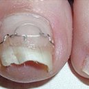 레푸스 화정점 이미지