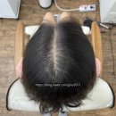 여성가르마 헤어팡팡하면 머릿결손상 있어요 ... 이제 간편한 SMP두피문신 받으세요!