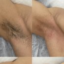 두비두왁