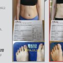 다이어트 건강요가 | SNPE 건강 다이어트 후기: 몸매·통증·피부 3가지를 동시에 잡은 비밀 -SNPE 라쌤이 알려드려요!