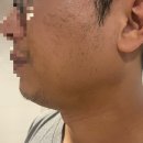 영프로모션 | 도루코 슬릭 모션 쉐이빙폼 내돈내산 사용 후기 + 슬릭 면도기 1달 사용 후기