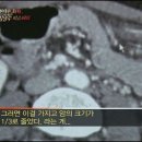 [이야기] 화타 혹은 사기꾼 .. 구당 김남수 이미지