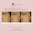 올뷰티의원대전유성 이미지