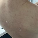 대양약국 | 부산 서면 등드름 여기가지마세요! 더모어뷰티 서면본점