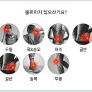몸의중심 | 성남체형교정 몸의중심 T체형교정 후기(발가락 교정기 제작)