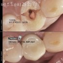 베스트e치과의원 네이버블로그
