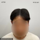 레이븐스칼프 이미지