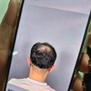 디블랙아카데미광주점 | 남편 정수리 두피문신 6회차 끝, <디블랙 광주점> 솔직한 내돈내산 후기