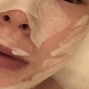 동탄반석로 | 반송동피부샵 루스파에서 LDM 관리받은 후기