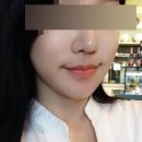 에스탑성형피부 네이버블로그