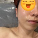 강남 대치동 피부관리 더윤 에스테틱 근막관리 후기