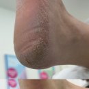 레푸스