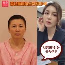 청춘의원 네이버블로그