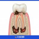 단계뿌리깊은치과 네이버블로그