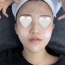 울산 동구 피부관리실 바이오즈 후기