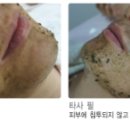 예인피부관리 이미지