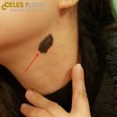 셀레스의원 네이버블로그