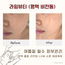 라임스킨케어 - 파주시 | 여름에도 건조하고 당기는 피부, 평택 피부관리 [라임뷰티] 에서 관리받은 후기