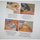익산S한의원 네이버블로그