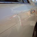 크라운덴트 이미지