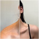 진마디의원 | 닥터스피부과강북미아, 승모근 보톡스 내돈내산 솔직 후기(feat. 전문의)