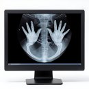 노치과의원 | 치과 갈 때마다 쫄보 되는 사람? 나야 나!