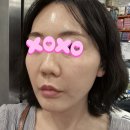 셀마트 | [뷰마르 대전판암점]대전 피부관리 추천, 대전 셀부스터 속보습 관리 후기