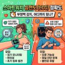 스마트워치 심전도(ECG) 정확도 분석: 부정맥 감지 어디까지 믿을 수 있나