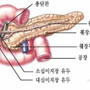 췌장암 술.담배 당뇨와관련 이미지